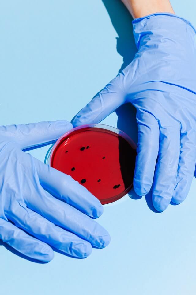 A technician collecting samples in modern diagnostic laboratory | Driptoyou